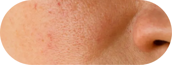 Primer facial que calma e hidrata la piel