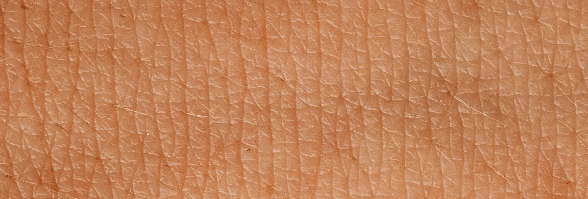 La piel seca se apoderó de mi vida