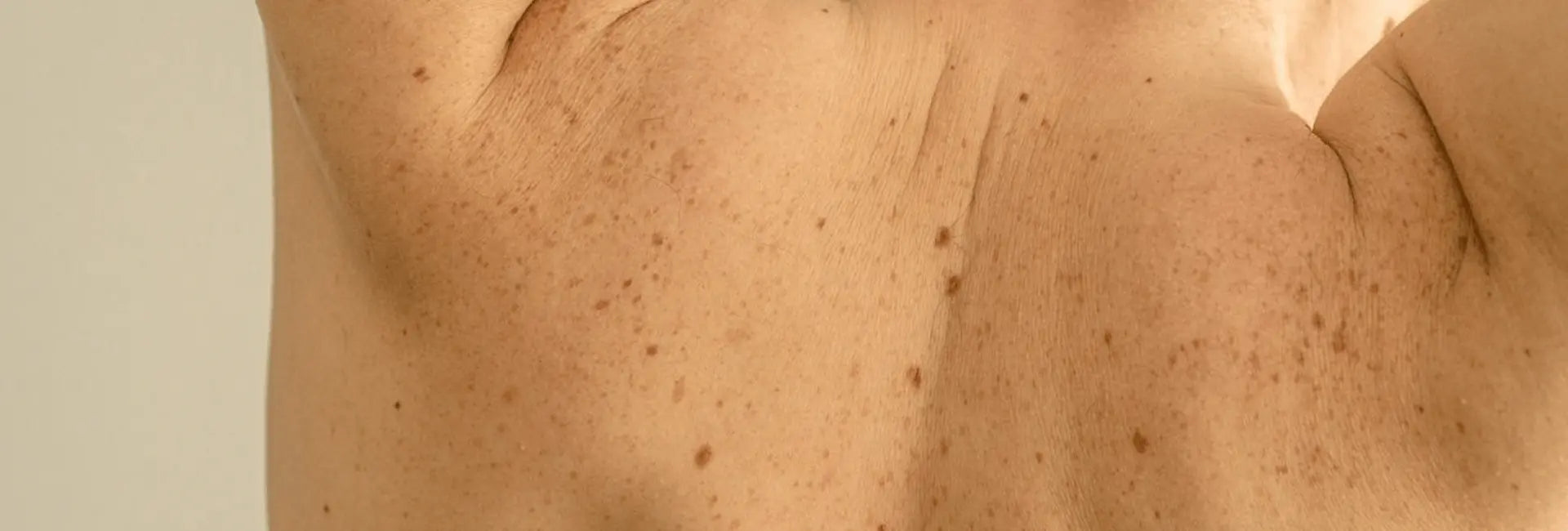 Lunares: Una constelación de mil historias