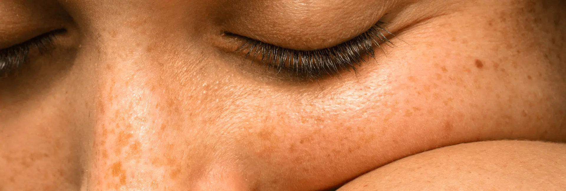 Por fin las pecas se pusieron de moda